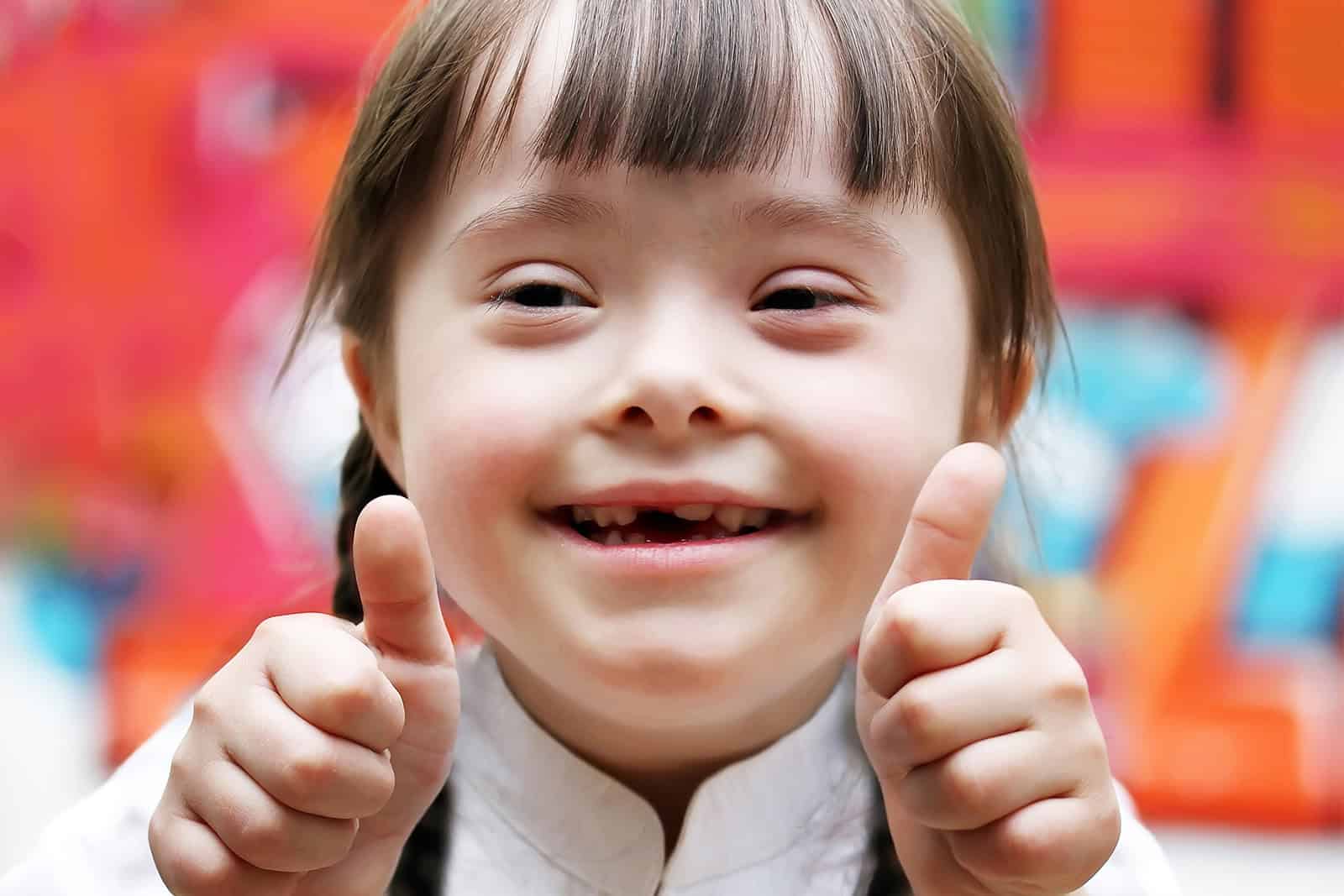 https://smiline.com/wp-content/uploads/2024/09/special-needs-child.jpg