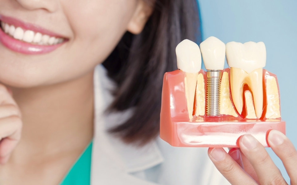 Signs You Might Be Ready for Dental Implants: A Self-Assessment Guide