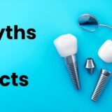 Myths vs. Facts: The Truth About Modern Dental Implants